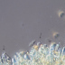 Vista superior (pileus)